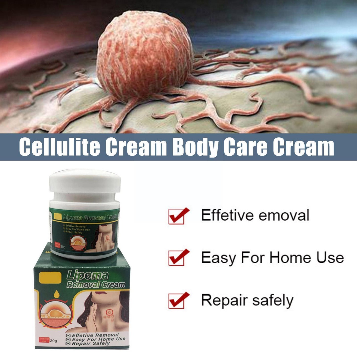 Anti-tumor Lipoma Cream