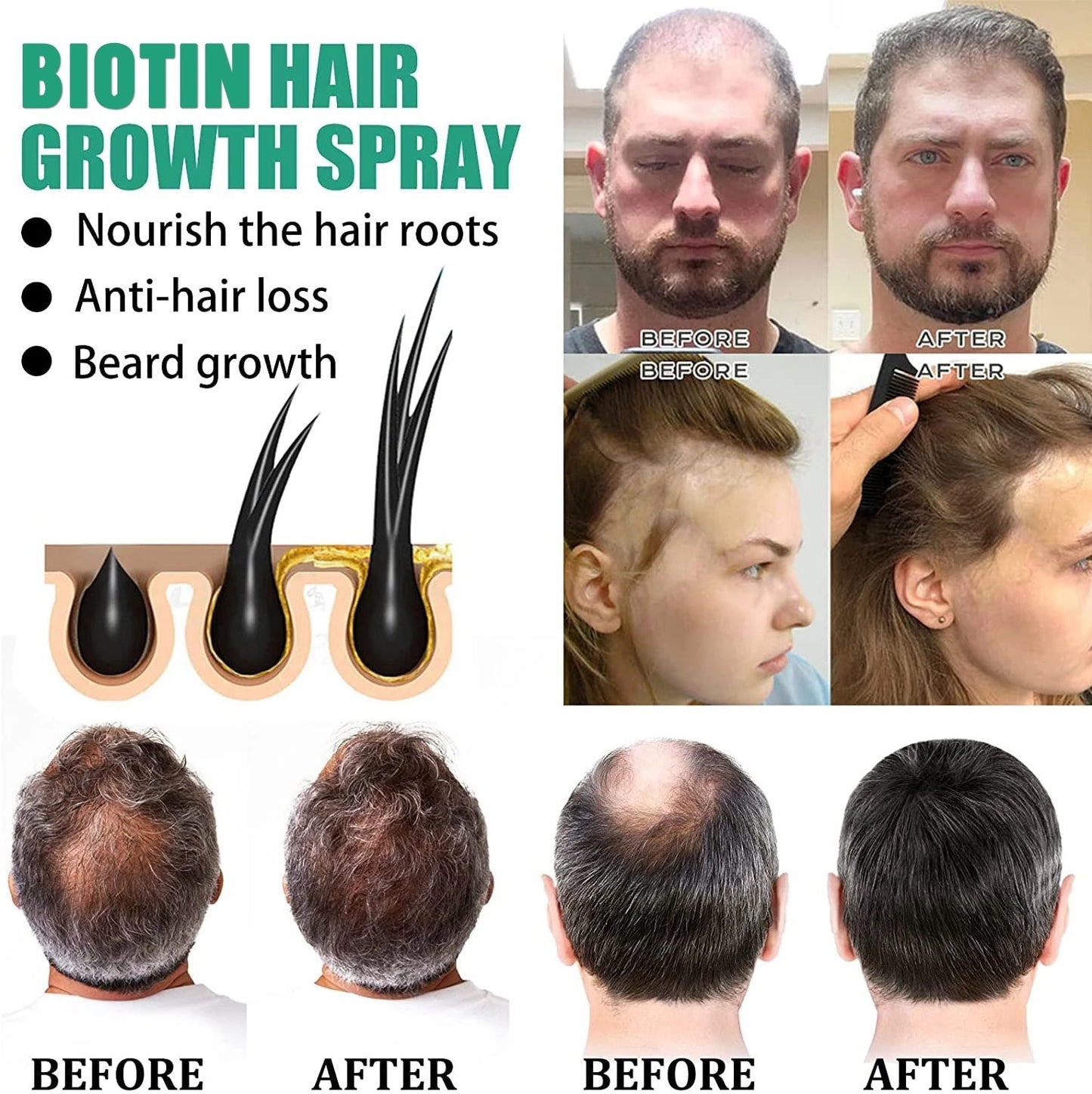 Hair Loss Nourishing Liquid