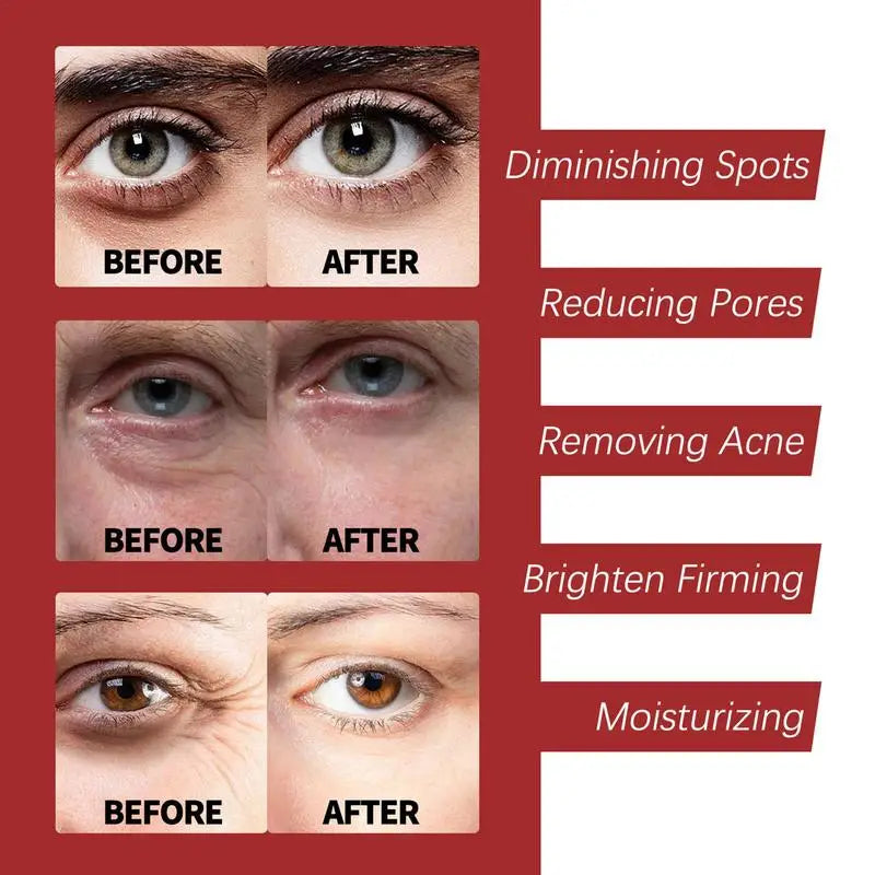 Retinol Wrinkle Remover Cream