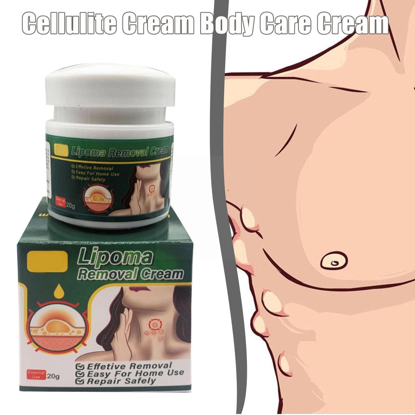 Anti-tumor Lipoma Cream
